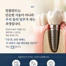 유디서현치과의원 | 임플란트 수명, 얼마나 될까? 유디서현치과의 '10년 책임 보증' 시스템 안내
