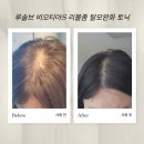카페로티아 | [탈모 토닉] 루솔브 비오티아S 리볼좀 탈모완화 토닉 사용 후기