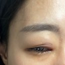 더드림안과의원 이미지