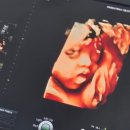 수서나을산부인과의원 이미지