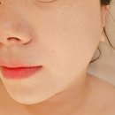 세븐일레븐(창원도계연화점) | 탄력 이중턱 심부볼 걱정될 땐 창원윤곽관리 라운드어바웃