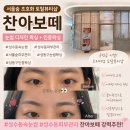 성수동눈썹왁싱 찬아보떼 | 아치형 눈썹 디자인 만족 후기