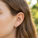 뇌졸중의 예방과 치료 | 귓볼주름 뇌졸증 신호일까? 뇌졸중 전조증상 꼭 알아야할 포인트