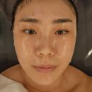 [상암 피부관리]리뉴에스테틱|피부종합영양제같은 프리미엄피부관리 받은 솔직후기