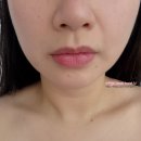 레브 | 부산금정구피부관리 윤하뷰티 미레브 후기!