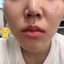 뷰티온의원평택고덕점 네이버블로그