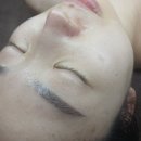 윤메디 | 양주에스테틱 윤메디테라피 플라즈마관리 생생후기