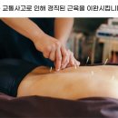 수원역광장 한의원 이미지