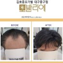 매직가발