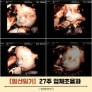 세심태권도 | 아이산산부인과 27주 입체초음파 비용/백일해/태동 활발한 뿌미