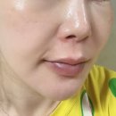 늘푸른세탁소 | 피부관리 올가스킨 평화푸른마을점 예비신부 플라즈마 화이트 토닝관리 물방울 초음파 관리받고 온 후기