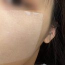 닥터비타 [비타민B 포어 앤 세범 밸런싱 모공패드 80매] 사용 솔직후기