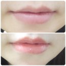 구원2 | 👉얇은 입술 구원템/ 수퍼부스트 립글로스 2통째 솔직후기