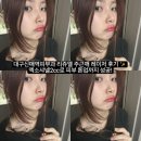 신매역 | 대구신매역피부과 리쥬엘 주근깨 레이저 후기 ✨ 엑소샤넬2cc로 피부 톤업까지 성공!