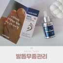 엄지발톱통증 발톱소독 라셀턴 15일 챌린지 참여하기