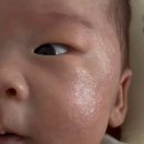 [아토앤오투][제로이드] 신생아 태열 관리 내돈내산...젤 + 제로이드 MD 인텐시브 크림 재생/보습크림 후기