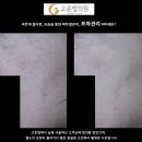 순천의원 티스토리
