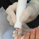 순천고용센터 | 순천 문제성 내성 발톱 관리 더네일앤푸스 1차 방문 후기