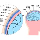 지주막(=뇌 척수막 중 중간부분)하 출혈 리스크를 낮추기 위한 방안은? 콜레스테롤, 혈당치, 혈압을 낮추는 일반약. 이미지