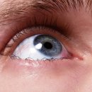 예성정안과의원 이미지