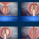 베스트비뇨기과 이미지