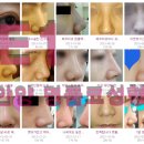 연세이원성형외과의원 이미지