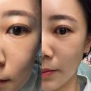 옆집떡볶이의정부역점 | 얇은 직모 속눈썹펌으로 추천하는 의정부속눈썹지니데이