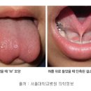 청주미즈맘산부인과의원 네이버블로그