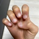 J mood nail(제이 무드 네일) | 서울 도봉 :: 쌍문역 네일 마스터제이네일 물어뜯는 손톱 교정 3차 후기 이제는 손톱을 보여주고 싶어졌다