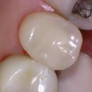 크라운치과의원 이미지