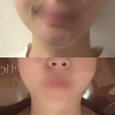 6615 | [분당] 분당피부관리실 : 벨라인 에스테틱 분당 서현점에서 베이직관리 받은 후기