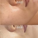 숨 피부관리 이미지