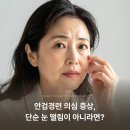 247외과의원 | 안검경련 증상 원인, 치료 방법과 눈꺼풀 성형 주의사항