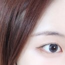 디앤에이피부과의원 | 압구정 피부과 탈모 치료 모발 이식 전문 병원 | 헤어셀 모낭주사 후기