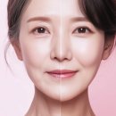 샤인성형외과의원 | 강동구 실리프팅 비용 비교 (성형외과 피부과)