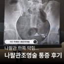 갈생 | amh 1점대 난저, 나팔관 한쪽 막힘 나팔관조영술 통증 후기