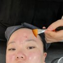 황금동 피부관리 효에스테틱 꼼꼼한 압출과 라라필 받고 온 후기! 수성구 에스테틱