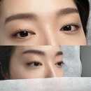 [상일동역] 고덕눈썹 눈숲달숲 브로우 :: 상일동 자연눈썹 후기 (비포/애프터)