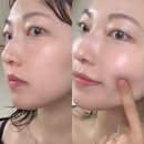 닥터엔톡스 여자남자 올인원 주름개선 크림 기능성화장품 솔직 후기