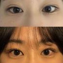 3뷰티 | 가산디지털단지: 가산동속눈썹펌 <eye보리뷰티 >1~3일차 후기, 비포애프터 사진