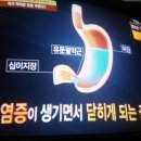 위염증.양배추/천기누설/온라인수련/기치유 이미지