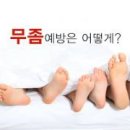 무좀(Tinea pedis) 발톱무좀 이미지