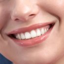 에스(S)리더치과병원 이미지