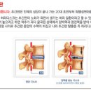 라임나무한의원 이미지