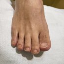 더숲 | 안양 평촌역 내성발톱 반복되는 아픔에 참다 방문한 더숲 후기