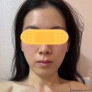 장달문 | 일산 에스테틱 경락마사지 어메이징 빅토리아 2회차 내돈내산 솔직후기