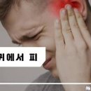 귀에서 피나는 원인 건강하게 관리하는 법 이미지