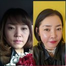 인셀덤 원 - 군산시 | 화장 잘 먹는 피부 만드는 법, 인셀덤 3종 사용 후기