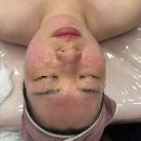 아이원메디칼 | [올가드림뷰티송도점]송도 피부관리 에스테틱 모공디톡스 관리샵