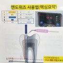 분당서현동 하얀치과 고주파신경치료 데모 들어간 날(feat. 엔도위즈)